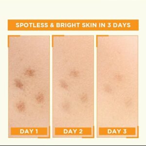 Garnier Skin Naturals Vitamin C Serum 30ml Brightening Spot Lightener - Image 4
